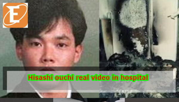 Hisashi ouchi real video in hospital
